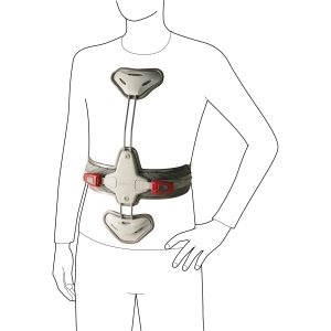 Трехточечный ортез для грудо-поясничного отдела